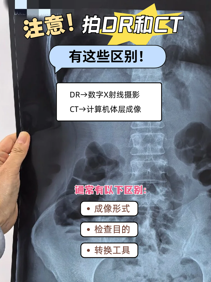 ctq与ctf区别 ctf和ctq的区别 